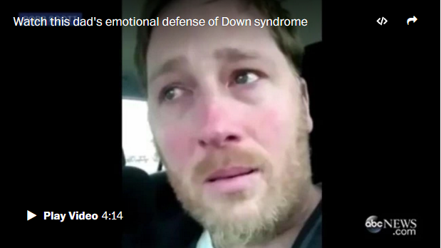 Why this father says ‘Down syndrome is the best thing that ever happened to me’ Why this father says ‘Down syndrome is the best thing that ever happened to me’